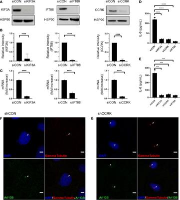 Glioblastoma may evade immune surveillance through primary cilia-dependent signaling in an IL-6 dependent manner